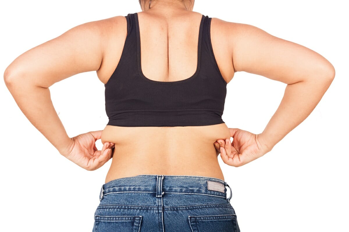 Eliminating the Stubborn “Bra Bulge” and Back Fat